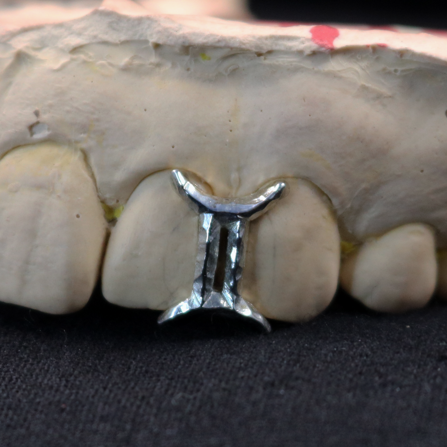 Star sign Grillz